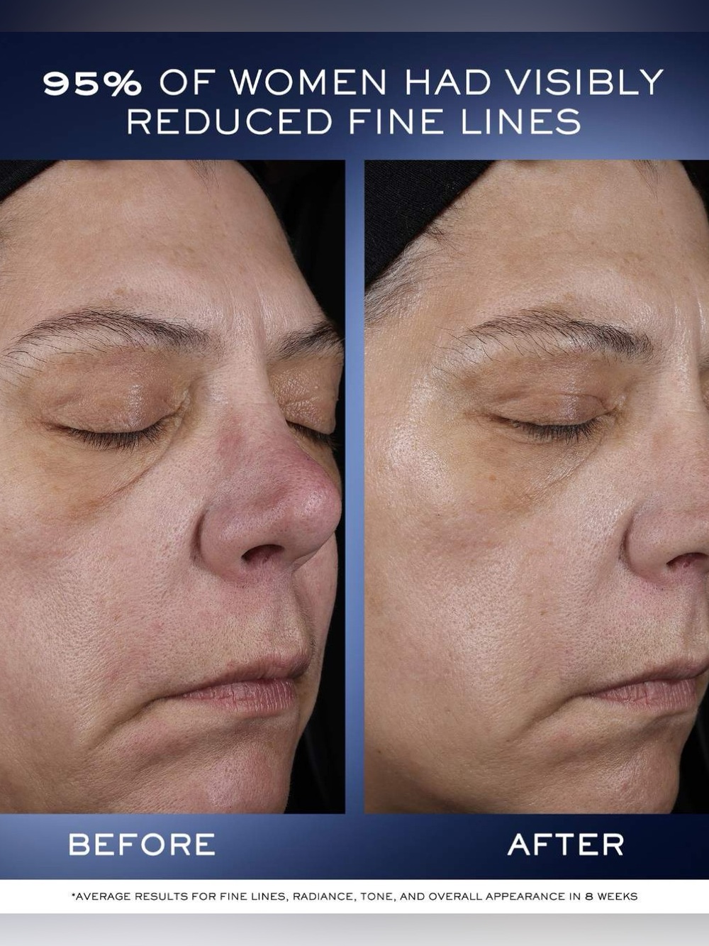 Lancôme Génifique Ultimate Recovery Serum for Skin Barrier Repair - Picture 4 of 5